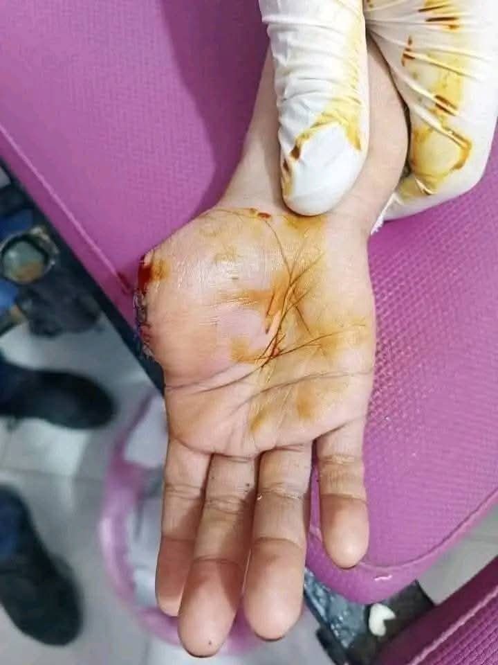 محلى نجع حمادى واليوم الثالث على التوالى وحملات مكافحة بائعى ومروجى الالعاب النارية بشتى صورها والصواريخ